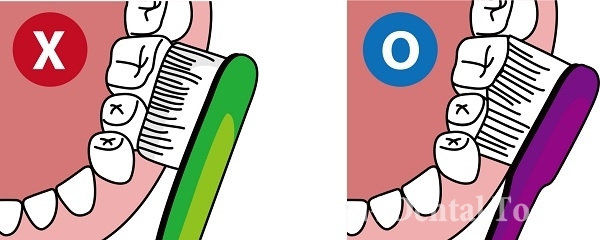 치간 사이에 칫솔모가 들어가도록 닦는 것이 좋다.