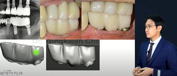 최용관 원장의 ‘똘똘한 친구 3D 프린터(개원가에서 3D프린터의 적용’ 강연.