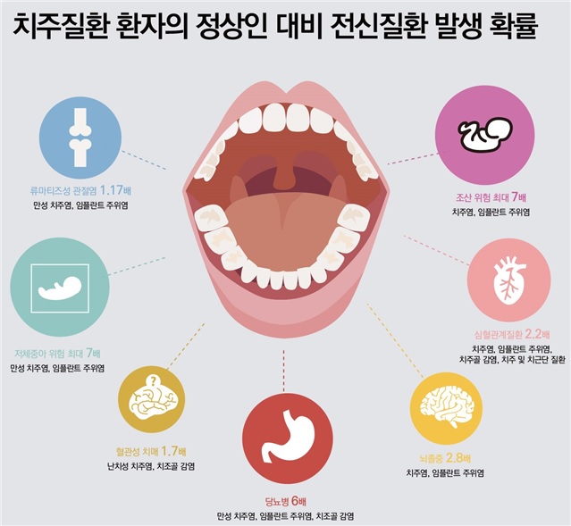치주질환 환자의 정상인 대비 전신질환 발생확률.