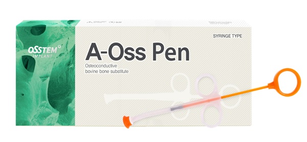우수한 이종골 이식재로 호평받는 A-Oss, A-Oss Collagen에 이어 오스템이 세 번째로 선보인 ‘A-Oss PEN’은 시린지 타입이라 수화 편의성과 시술편의성이 뛰어나다.