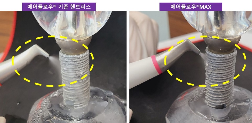 에어플로우 MAX 핸드피스 비교 사진.
