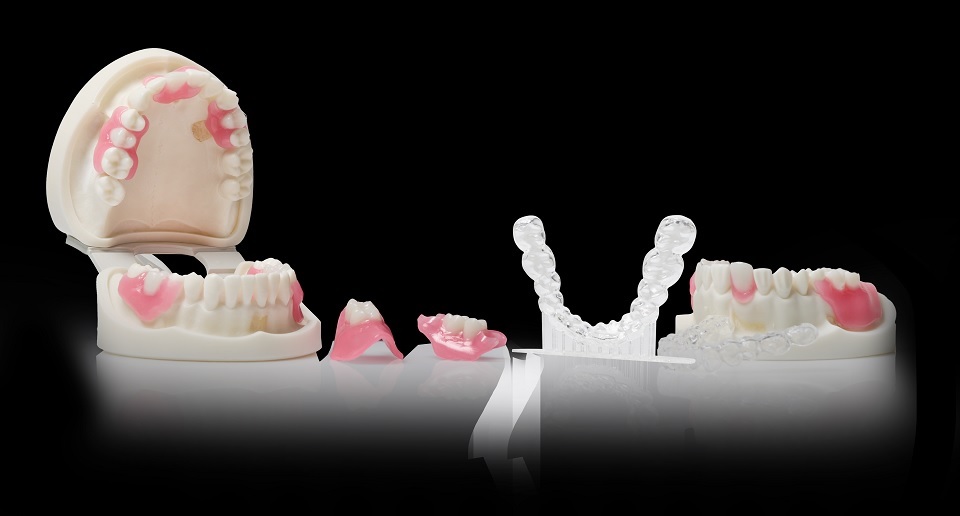 덴티스가 새로 선보인 3D프린터 전용 플렉시블 레진 ‘FLEXIBLE’ 출력물